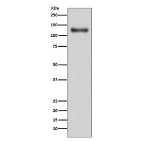 Western blot testing of human A431 cell lysate with LAMP1 antibody. This heavily glycosylated protei