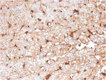 IHC staining of FFPE human liver with APOD antibody. HIER: boil tissue sections in pH 9 10mM Tris wi