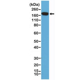Western blot of human HeLa cell lysate using recombinant EGFR antibody at a 1:200 dilution. Expected