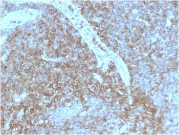 IHC staining of FFPE human lymph node with recombinant CD44 antibody (clone HCAM/2875R). HIER: boil 