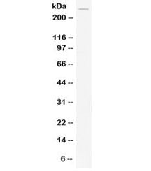 Western blot testing of human HeLa lysate with APOB antibody at 0.5ug/ml. Predicted molecular weight