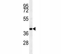 CCR8 Antibody