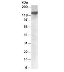 Western blot testing of nuclear HeLa lysate with DHX9 antibody at 1ug/ml. Predicted molecular weight