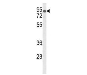 Western blot analysis of LDLR antibody and mouse lung tissue lysate. Expected molecular weight: 95-1