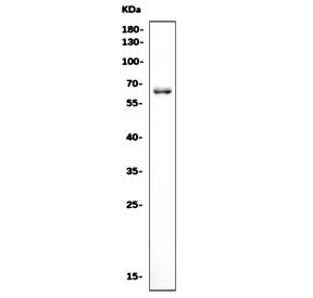 Western blot testing of rat brain tissue with Crmp4 antibody. Predicted molecular weight ~62 kDa.