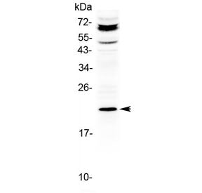 Western blot testing of human HepG2 cell lysate with ANGPTL8 antibody at 0.5ug/ml. Predicted molecul