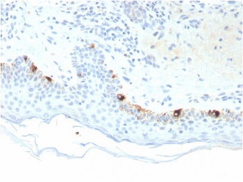 TRP1 / Tyrosinase-Related Protein-1 Antibody
