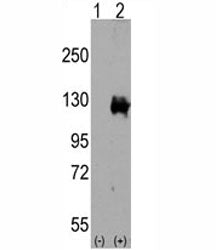 TRPM8 Antibody