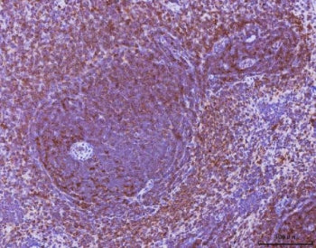 IHC staining of FFPE rat spleen tissue with Mip-1 alpha antibody. HIER: boil tissue sections in pH8 