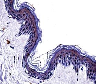 Tyrosinase Antibody