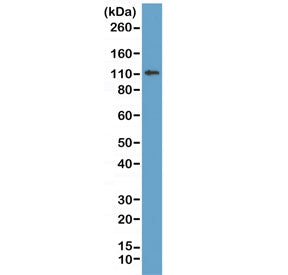 E-Cadherin Antibody / CDH1