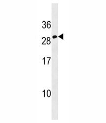 Erythropoietin Antibody (EPO)