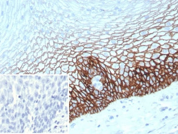 IHC staining of FFPE human esophagus tissue with recombinant CD44v6 antibody (clone CD44V6/9400R). I