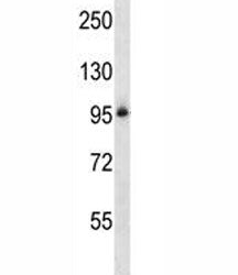 Integrin beta 5 Antibody