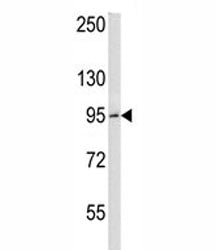 BCL6 Antibody