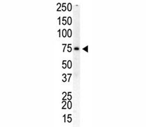 PIP5K1B Antibody