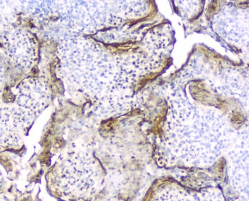 Elafin Antibody / SKALP / WFDC14