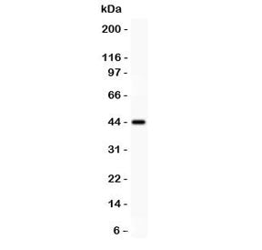Mesothelin Antibody
