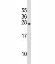 Prolactin Antibody