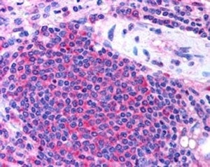 IHC testing of FFPE human spleen with UBASH3A antibody at 2.5ug/ml. HIER: steamed with pH6 citrate b