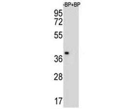 MBP Antibody (Myelin Basic Protein)