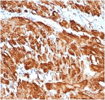 Actin Antibody (smooth muscle)