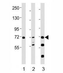 Western blot testing of SYK antibody at 1:2000 dilution. Lane 1: THP-1 lysate; 2: Ramos lysate; 3: m