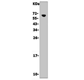 Western blot testing of mouse thymus lysate with Cd16 antibody. Expected molecular weight: 30-70 kDa