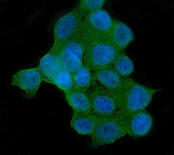 AKT2 Antibody