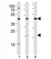 TGFB1 Antibody