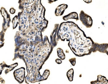 IHC staining of FFPE human placental tissue with SND1 antibody. HIER: boil tissue sections in pH8 ED
