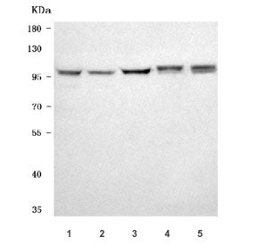 Western blot testing of 1) human HeLa, 2) human 293T, 3) human K562, 4) rat brain and 5) mouse brain