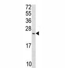 Bax Antibody