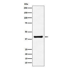Aldolase A Antibody / ALDOA