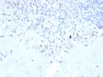 IHC staining of FFPE human lymph node with recombinant PU.1 antibody (clone rPU1/2146). HIER: boil t