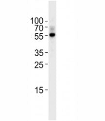 TGF Beta 2 Antibody