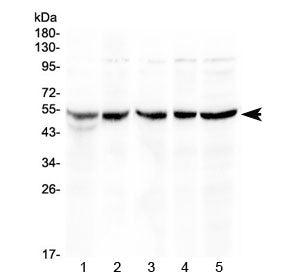 Western blot testing of 1) rat thymus, 2) mouse thymus, 3) mouse spleen, 4) human COLO320 and 5) hum