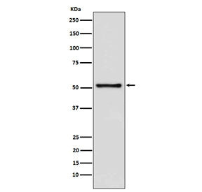 TdT Antibody