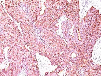 Chromogranin A Antibody