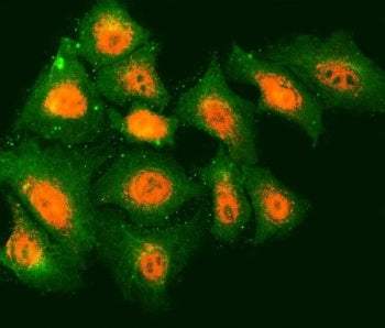 Tropomodulin 2 Antibody / TMOD2