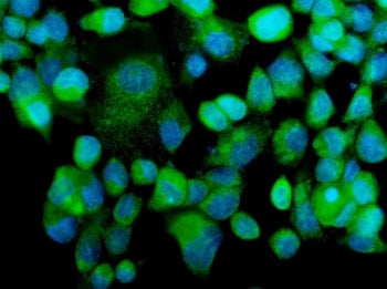 Immunofluorescent staining of FFPE human A431 cells with MEKK2 antibody (green) and DAPI nuclear sta