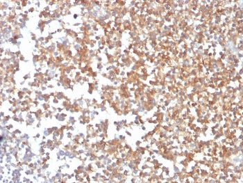 IHC staining of FFPE human kidney with CD10 antibody (clone MME/3739). HIER: boil tissue sections in