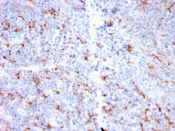 S100A9 + Calprotectin Antibody