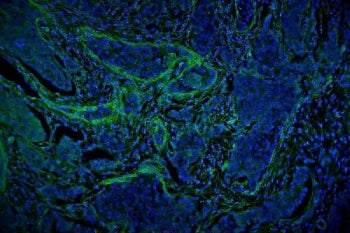 Vinculin Antibody