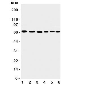 Western blot testing of Apoptosis-Inducing Factor antibody and Lane 1: rat heart; 2: (r) brain; 3: human K562; 4: (h) HEPG2; 5: (h) A431; 6: mouse NIH3T3 cell lysate. Expected/observed molecular weight: ~67kDa.