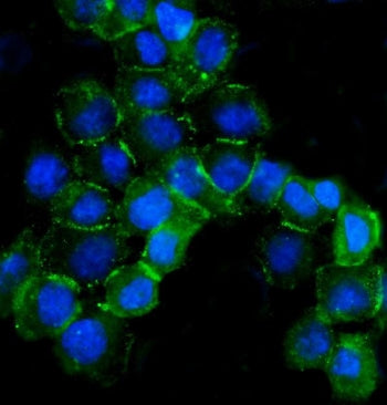 Beta Catenin Antibody
