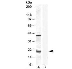 Western blot testing of human prostate lysate with GPX7 antibody at 0.3ug/ml with [B] and without [A