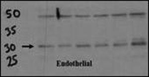 DSCR1 Antibody