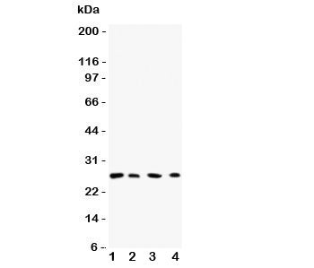 Western blot testing of Rab3C antibody and Lane 1: rat brain; 2: human HeLa; 3: (h) 293T; 4: (h) COL