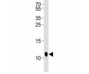 SUMO Antibody (Drosophila)